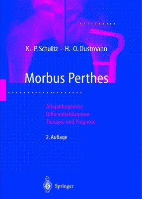 Klaus-Peter Schulitz, Hans-Otto Dustmann - Morbus Perthes, Inbunden. Tillgänglighet: Lägg i varukorg