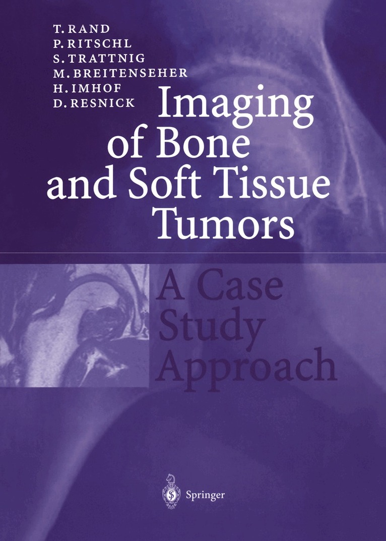 T. Rand, P. Ritschl, S. Trattnig, M. Breitenseher, H. Imhof, D. Resnick - Imaging of Bone and Soft Tissue Tumors, Häftad. Tillgänglighet: Lägg i varukorg