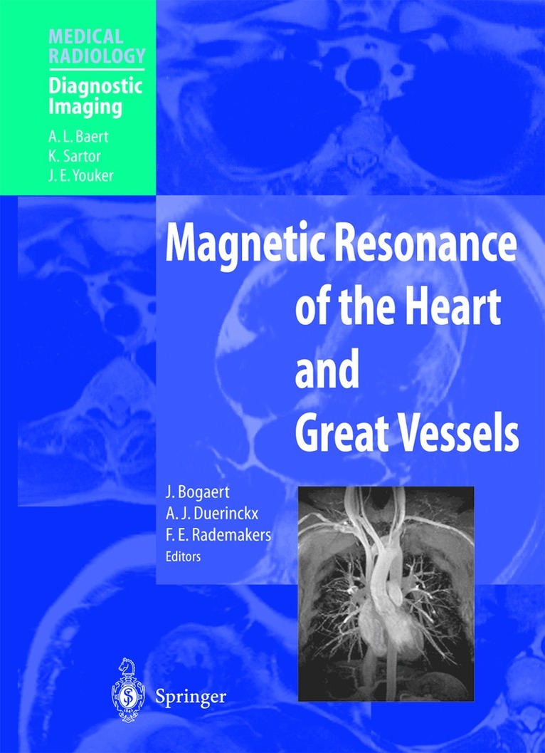 J. Bogaert, A.J. Duerinckx, F.E. Rademakers - Magnetic Resonance of the Heart and Great Vessels, Häftad. Tillgänglighet: Lägg i varukorg