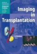 Imaging in Transplantation