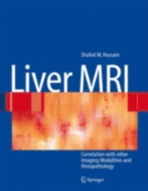 Shahid M. Hussain - Liver MRI, E-bok. Tillgänglighet: Lägg i varukorg