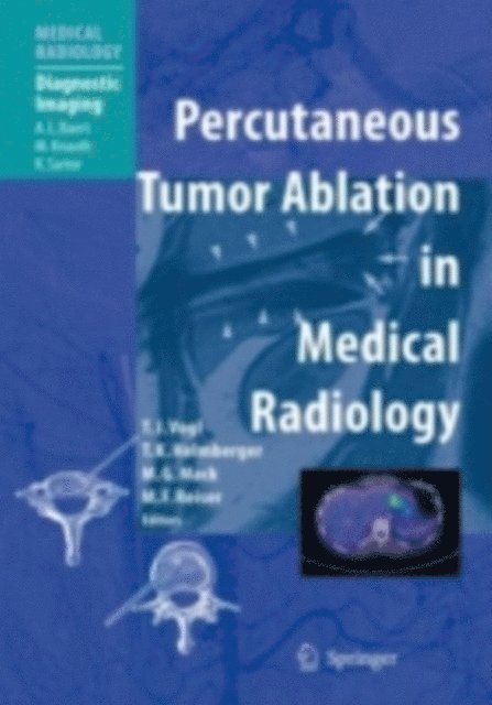 Maximilian F Reiser, Martin G. Mack, Thomas Helmberger, Thomas J. Vogl - Percutaneous Tumor Ablation in Medical Radiology, E-bok