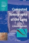 Computed Tomography of the Lung