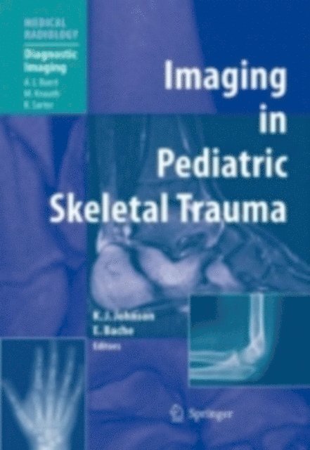 E. Bache, Karl J. Johnson - Imaging in Pediatric Skeletal Trauma, E-bok