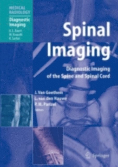 Paul M. Parizel, Luc van den Hauwe, Johan W.M. van Goethem - Spinal Imaging, E-bok