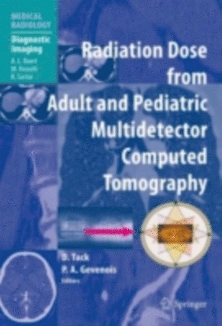 Pierre Alain Gevenois, D. Tack - Radiation Dose from Adult and Pediatric Multidetector Computed Tomography, E-bok