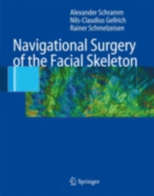 Rainer Schmelzeisen, Nils-Claudius Gellrich, Alexander Schramm - Navigational Surgery of the Facial Skeleton, E-bok