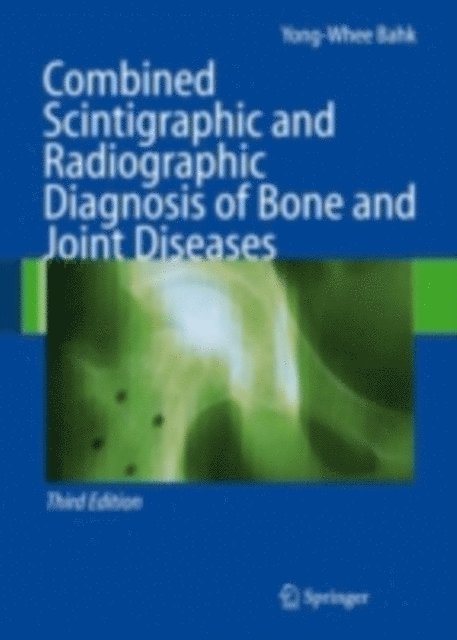 Yong-Whee Bahk - Combined Scintigraphic and Radiographic Diagnosis of Bone and Joint Diseases, E-bok