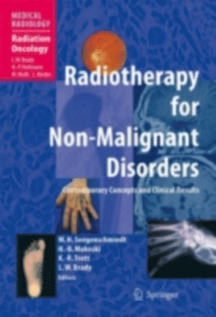 Luther W. Brady, Klaus-Rudiger Trott, Hans-Bruno Makoski, Michael Heinrich Seegenschmiedt - Radiotherapy for Non-Malignant Disorders, E-bok