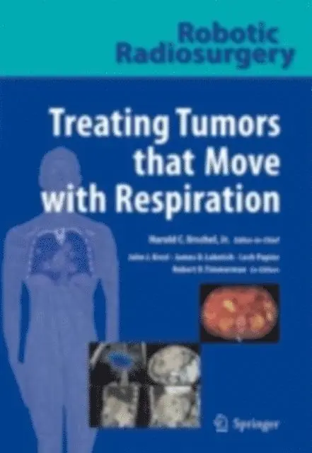 James D. Luketich, John J. Kresl - Robotic Radiosurgery. Treating Tumors that Move with Respiration, E-bok. Tillgänglighet: Lägg i varukorg