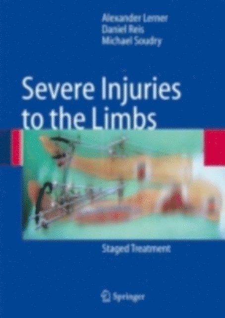 Michael Soudry, Daniel Reis, Alexander Lerner - Severe Injuries to the Limbs, E-bok
