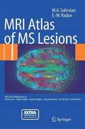 MRI Atlas of MS Lesions
