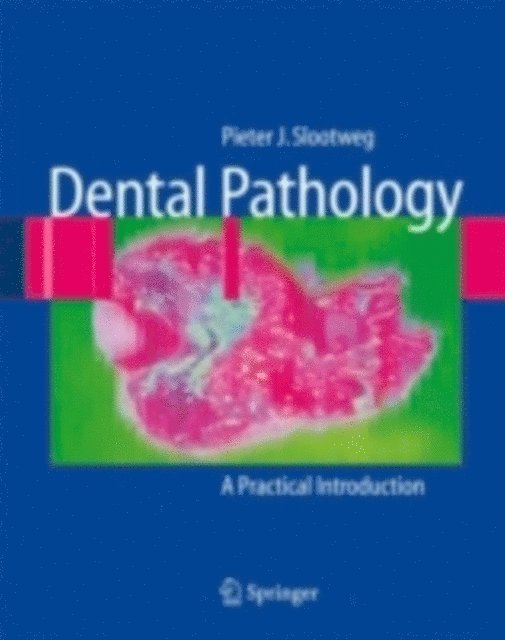 Pieter Slootweg - Dental Pathology, E-bok