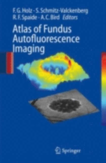 Alan C. Bird, Richard F. Spaide, Steffen Schmitz-Valckenberg, Frank G. Holz - Atlas of Fundus Autofluorescence Imaging, E-bok