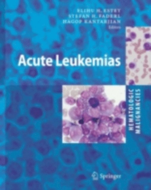 Hematologic Malignancies: Acute Leukemias