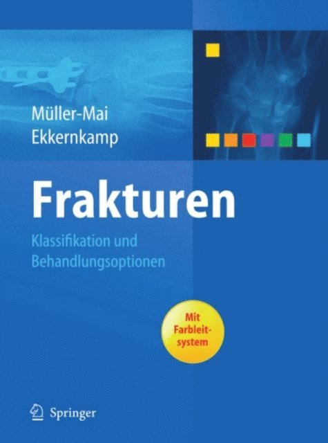 Axel Ekkernkamp, Christian Muller-Mai - Frakturen, E-bok