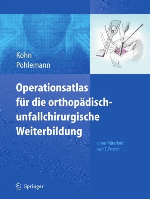 Tim Pohlemann, Dieter Kohn - Operationsatlas für die orthopädisch-unfallchirurgische Weiterbildung, E-bok