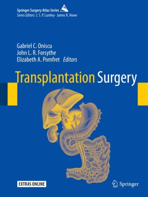 Elizabeth A. Pomfret, John L. R. Forsythe, Gabriel C. Oniscu - Transplantation Surgery, E-bok