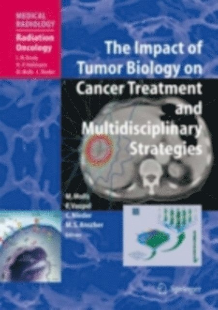 Mitchell Steven Anscher, Carsten Nieder, Peter Vaupel, Michael Molls - Impact of Tumor Biology on Cancer Treatment and Multidisciplinary Strategies, E-bok