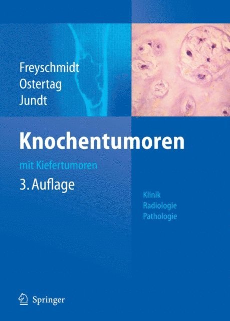 Gernot Jundt, Helmut Ostertag, Jurgen Freyschmidt - Knochentumoren mit Kiefertumoren, E-bok