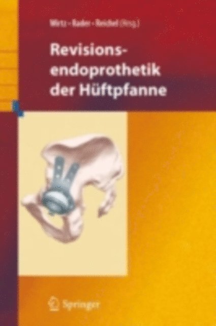 Heiko Reichel, Christof Rader, Dieter C. Wirtz - Revisionsendoprothetik der Hüftpfanne, E-bok