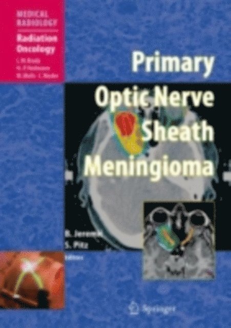 Susanne Pitz, Branislav Jeremic - Primary Optic Nerve Sheath Meningioma, E-bok