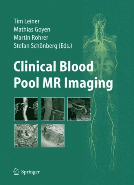 Stefan O. Schonberg, Martin Rohrer, Mathias Goyen, Tim Leiner - Clinical Blood Pool MR Imaging, E-bok
