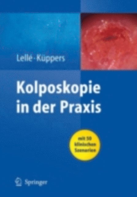 Volkmar Kuppers, Ralph J. Lelle - Kolposkopie in der Praxis, E-bok