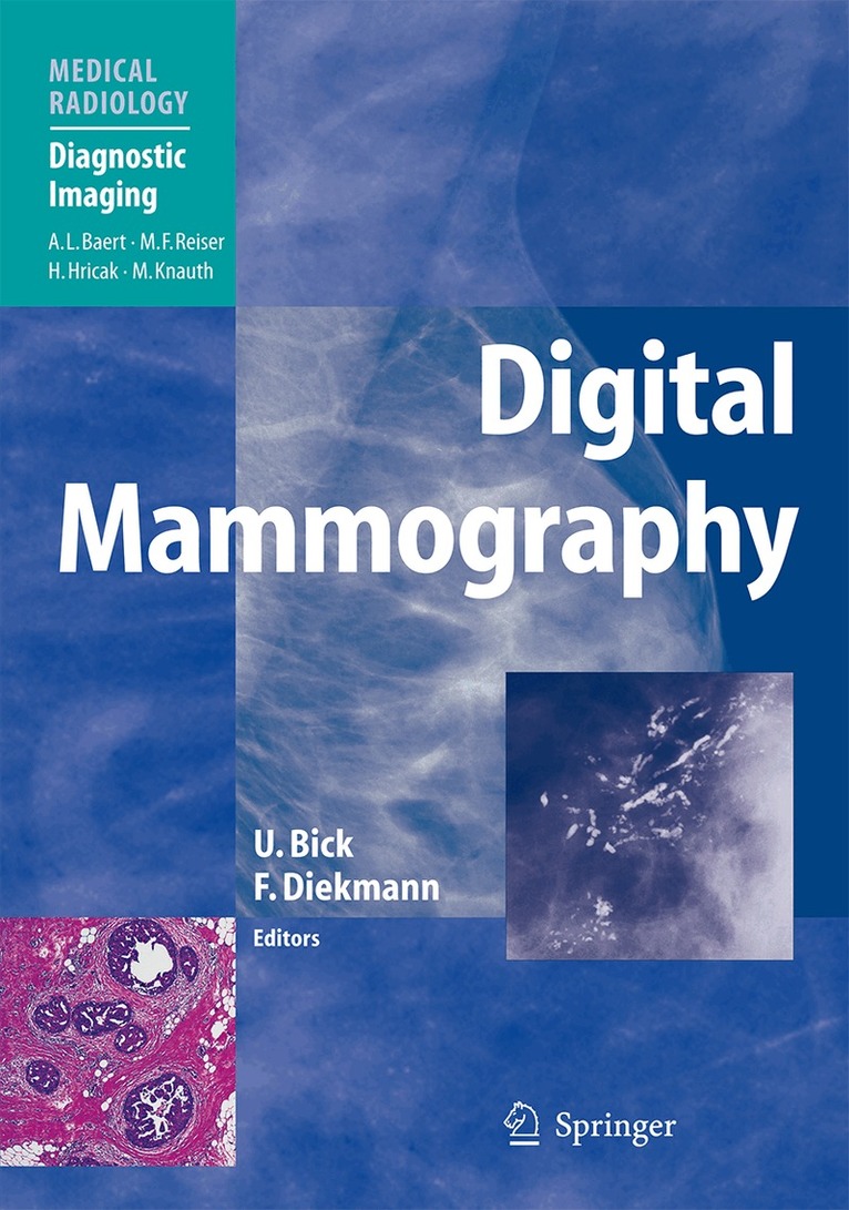 Ulrich Bick, Felix Diekmann - Digital Mammography, Inbunden