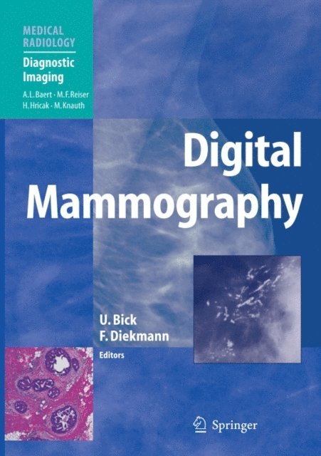 Felix Diekmann, Ulrich Bick - Digital Mammography, E-bok