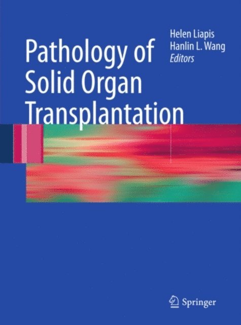Hanlin L. Wang, Helen Liapis - Pathology of Solid Organ Transplantation, E-bok