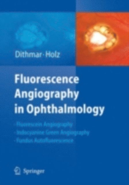 Frank G. Holz, Stefan Dithmar - Fluorescence Angiography in Ophthalmology, E-bok