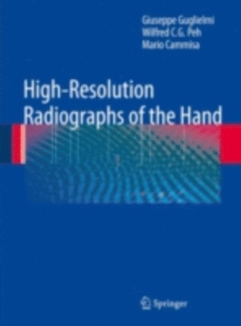 Mario Cammisa, Wilfred C. G. Peh, Giuseppe Guglielmi - High-Resolution Radiographs of the Hand, E-bok