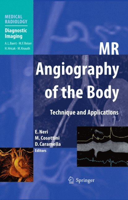 Davide Caramella, Mirco Cosottini, Emanuele Neri - MR Angiography of the Body, E-bok