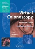 Virtual Colonoscopy