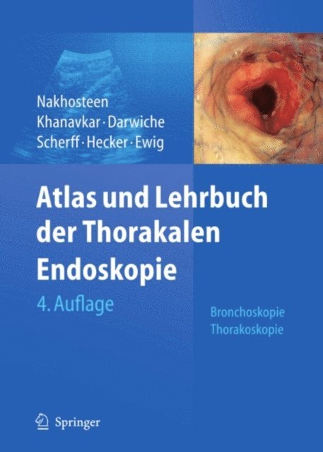 Santiago Ewig, Erich Hecker, Andreas Scherff, Kaid Darwiche, Barbara Khanavkar, John A. Nakhosteen - Atlas und Lehrbuch der Thorakalen Endoskopie, E-bok