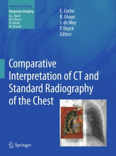 Philippe Duyck, Johan de Mey, Benoit Ghaye, Emmanuel E. Coche - Comparative Interpretation of CT and Standard Radiography of the Chest, E-bok