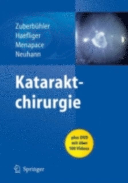 Thomas Neuhann, Rupert Menapace, E. Haefliger, Bruno Zuberbuhler - Kataraktchirurgie, E-bok