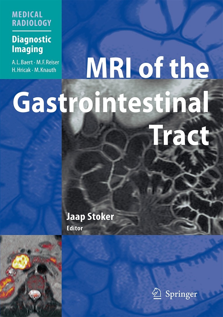 Jaap Stoker - MRI of the Gastrointestinal Tract, Inbunden
