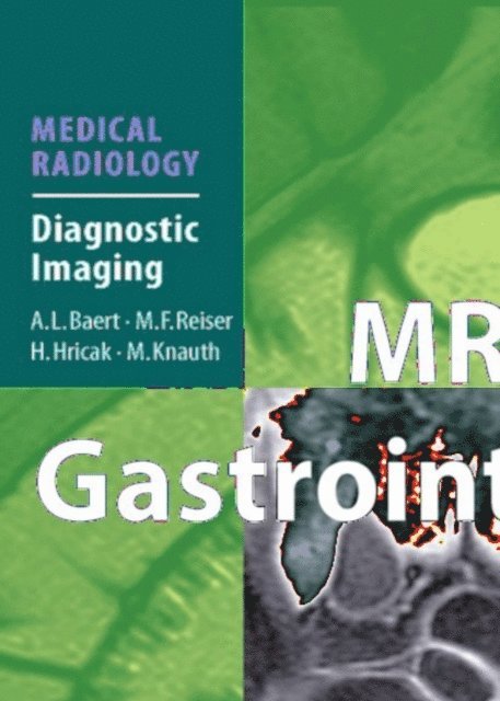 Jaap Stoker - MRI of the Gastrointestinal Tract, E-bok
