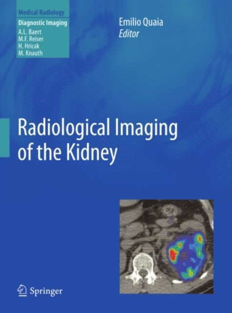 Emilio Quaia - Radiological Imaging of the Kidney, E-bok