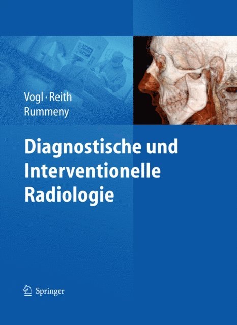 Ernst J. Rummeny, Wolfgang Reith, Thomas J. Vogl - Diagnostische und interventionelle Radiologie, E-bok