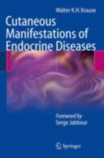 Walter K.H. Krause - Cutaneous Manifestations of Endocrine Diseases, E-bok. Tillgänglighet: Lägg i varukorg