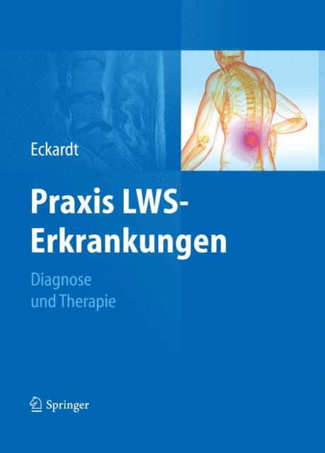 Anke Eckardt - Praxis LWS-Erkrankungen, E-bok