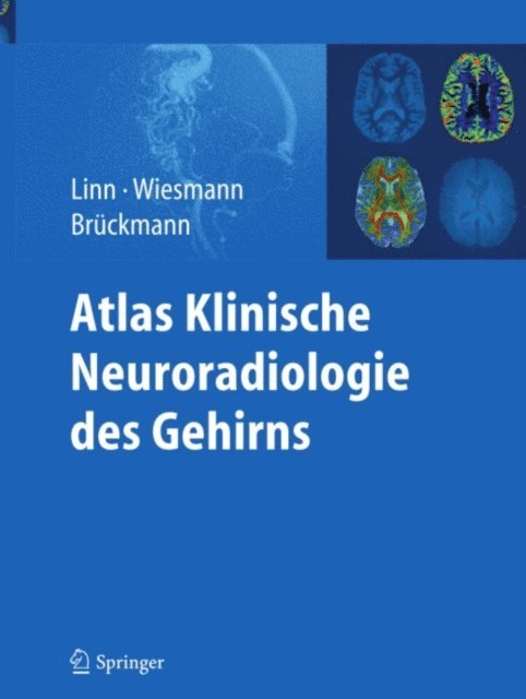 Hartmut Bruckmann, Martin Wiesmann, Jennifer Linn - Atlas Klinische Neuroradiologie des Gehirns, E-bok