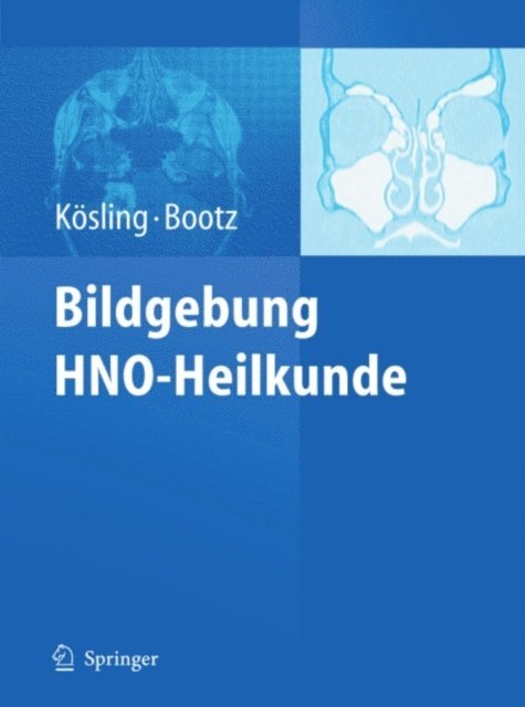 Friedrich Bootz, Sabrina Kosling - Bildgebung HNO-Heilkunde, E-bok