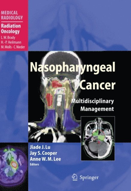 Anne W. M. Lee, Jay S. Cooper, Jiade J. Lu - Nasopharyngeal Cancer, E-bok