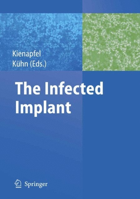 Klaus-Dieter Kuhn, Heino Kienapfel - Infected Implant, E-bok