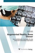 Augmented Reality Bone Viewer