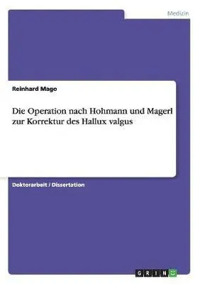 Operation nach Hohmann und Magerl zur Korrektur des Hallux valgus